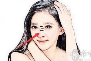 鼻梁纹女人面相分析 鼻梁纹怎么形成