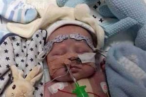 据报道,这名不幸又万幸的婴儿名叫查理·杜思韦特,10月2号出生在
