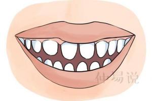 「牙齿面相」这三种牙齿的人需敬而远之,特别要注意最后一种